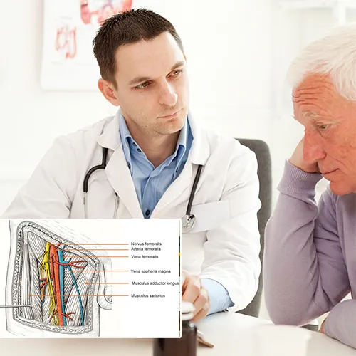 The Process of Material Selection for Surgery