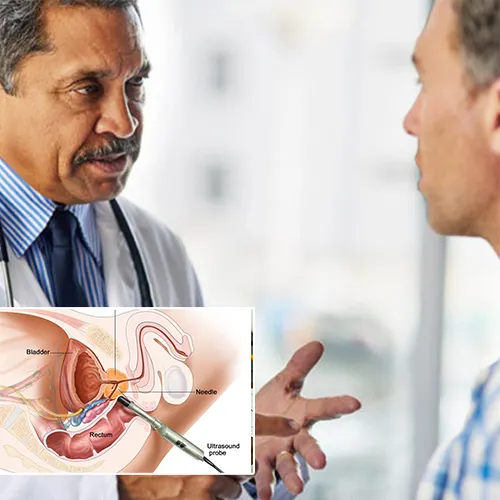 The Role Age Plays in Deciding on Penile Implant Surgery