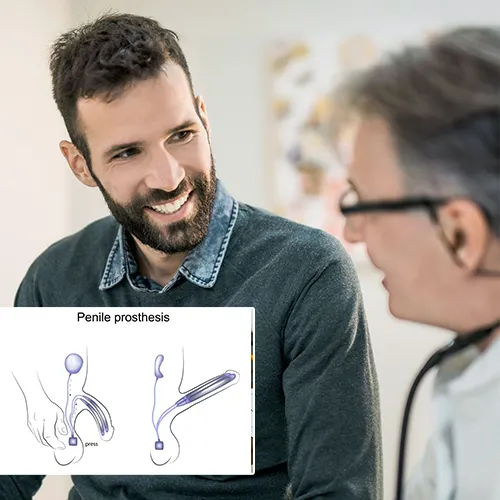 Seamlessly Integrating Penile Implant Surgery Into Your Life